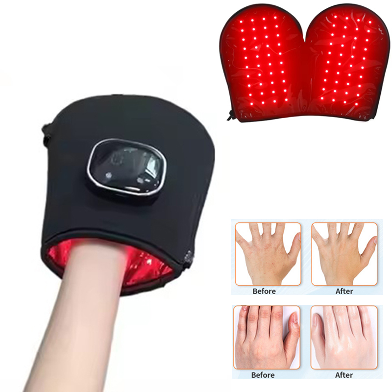 Heated Gloves Electric - جهاز جديد للعلاج بالضوء الأحمر لليدين،